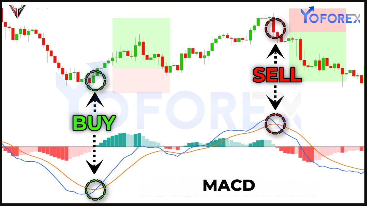 MACD