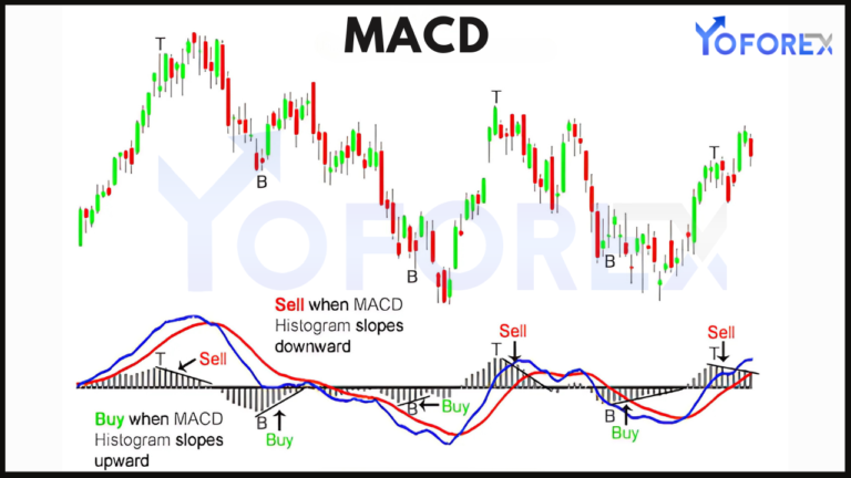 MACD